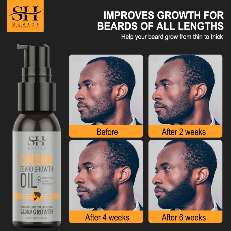 Beard Oil Growth - Sevich Men Beard Growth Essential Chebe
