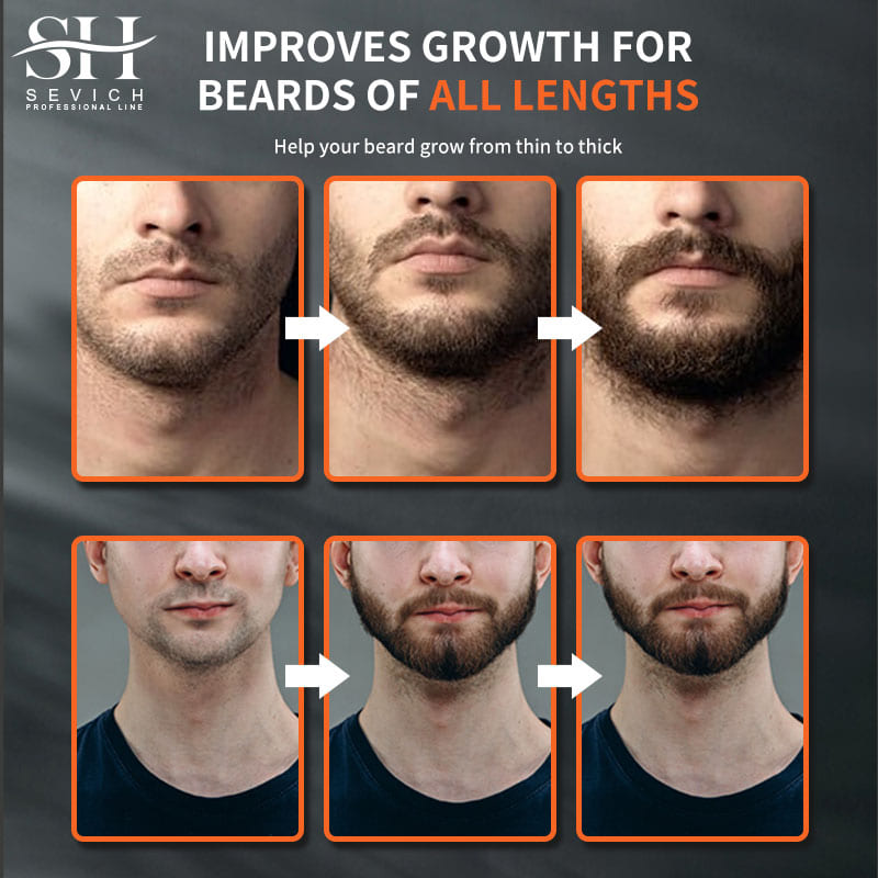 Sevich Men Beard Growth Essent - Beard Oil Growth ulasan dan harga