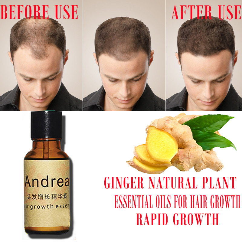 2/5/10Pcs Andrea Hair Growth S - Beard Oil Growth ulasan dan harga