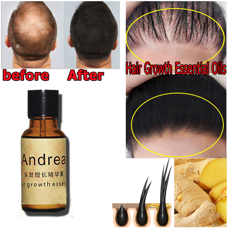 2/5/10Pcs Andrea Hair Growth S - Beard Oil Growth ulasan dan harga